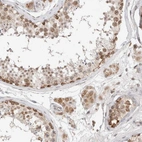 Immunohistochemical staining of human testis shows high expression.