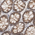 Immunohistochemical staining of human colon using Anti-MRM3 antibody HPA023031.