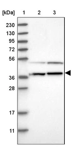 Lane 1: Marker [kDa] 230, 130, 95, 72, 56, 36, 28, 17, 11_br/_Lane 2: Human cell line RT-4_br/_Lane 3: Human cell line U-251MG sp