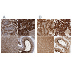 Anti-PCYT2 Antibody