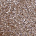 Immunohistochemical staining of human Liver shows strong granular cytoplasmic positivity in hepatocytes.