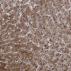 Immunohistochemical staining of human Liver shows strong granular cytoplasmic positivity in hepatocytes.
