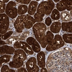 Immunohistochemical staining of human Kidney shows strong granular cytoplasmic positivity in cells in tubules.