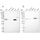 Western blot analysis using Anti-PCYT2 antibody HPA023033 (A) shows similar pattern to independent antibody HPA023034 (B).
