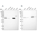 Western blot analysis using Anti-PCYT2 antibody HPA023033 (A) shows similar pattern to independent antibody HPA023034 (B).