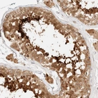 Immunohistochemical staining of human Testis shows strong granular cytoplasmic positivity in cells in seminiferous ducts and Leydig cells.