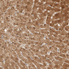 Immunohistochemical staining of human Liver shows strong granular cytoplasmic positivity in hepatocytes.
