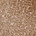 Immunohistochemical staining of human Liver shows strong granular cytoplasmic positivity in hepatocytes.