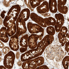 Immunohistochemical staining of human Kidney shows strong granular cytoplasmic positivity in cells in tubules.