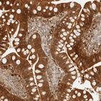 Immunohistochemical staining of human Small intestine shows strong granular cytoplasmic positivity in glandular cells.