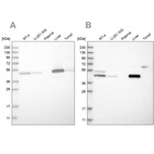Western blot analysis using Anti-PCYT2 antibody HPA023034 (A) shows similar pattern to independent antibody HPA023033 (B).