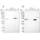 Western blot analysis using Anti-PCYT2 antibody HPA023034 (A) shows similar pattern to independent antibody HPA023033 (B).