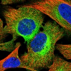 Immunofluorescent staining of human cell line U-2 OS shows localization to plasma membrane & cytosol.