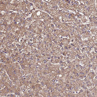 Immunohistochemical staining of human liver shows moderate cytoplasmic positivity in hepatocytes.