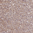 Immunohistochemical staining of human liver shows moderate cytoplasmic positivity in hepatocytes.