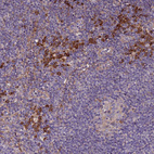 Anti-VMO1 Antibody