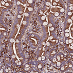 Anti-VMO1 Antibody