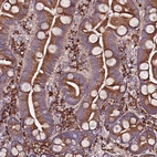 Immunohistochemical staining of human small intestine shows strong cytoplasmic positivity in glandular and lymphoid cells.