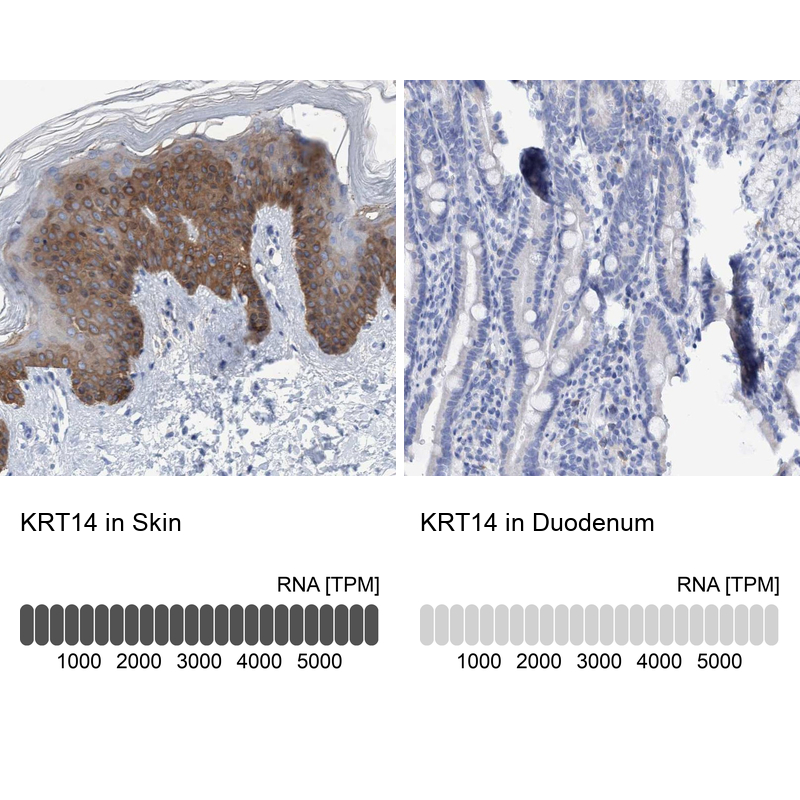 Anti-KRT14 Antibody