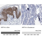 Anti-KRT14 Antibody
