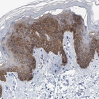 Immunohistochemical staining of human skin shows high expression.