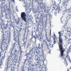 Immunohistochemical staining of human duodenum shows low expression as expected.
