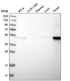 Western blot analysis in human cell line RT-4, human cell line U-251 MG, human plasma, human liver tissue and human tonsil tissue.