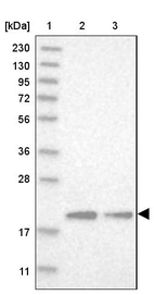 Lane 1: Marker [kDa] 230, 130, 95, 72, 56, 36, 28, 17, 11_br/_Lane 2: Human cell line RT-4_br/_Lane 3: Human cell line U-251MG sp