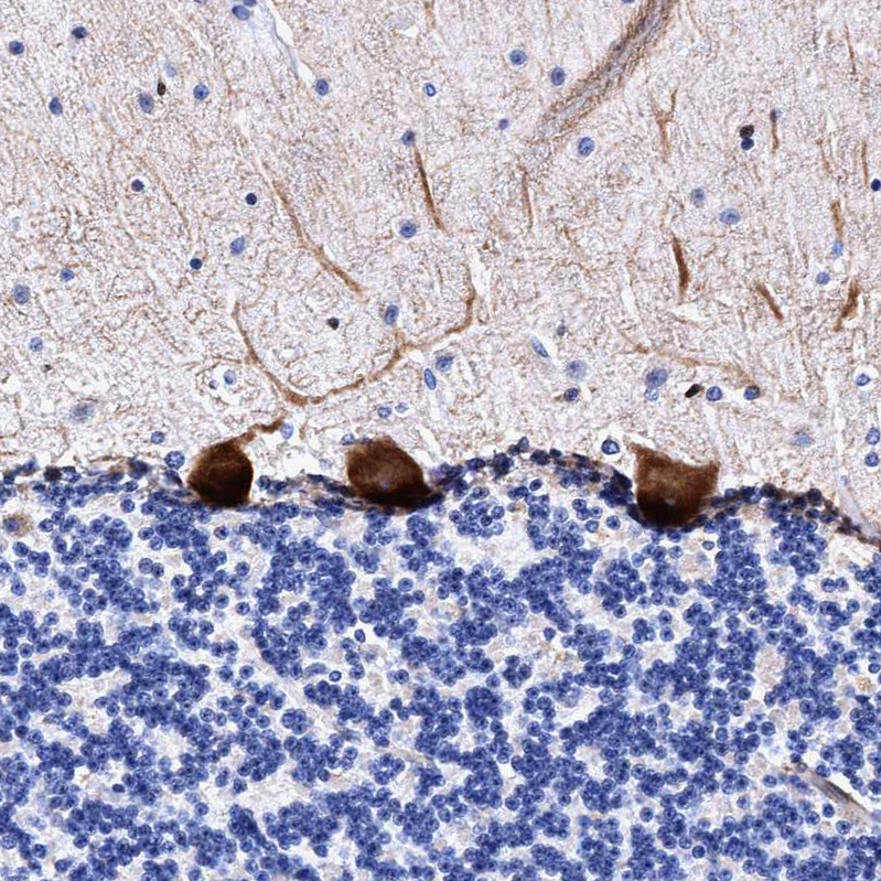 Anti-UBALD2 Antibody