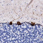 Anti-UBALD2 Antibody