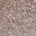 Anti-SLC25A10 Antibody