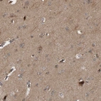 Anti-CUEDC1 Antibody