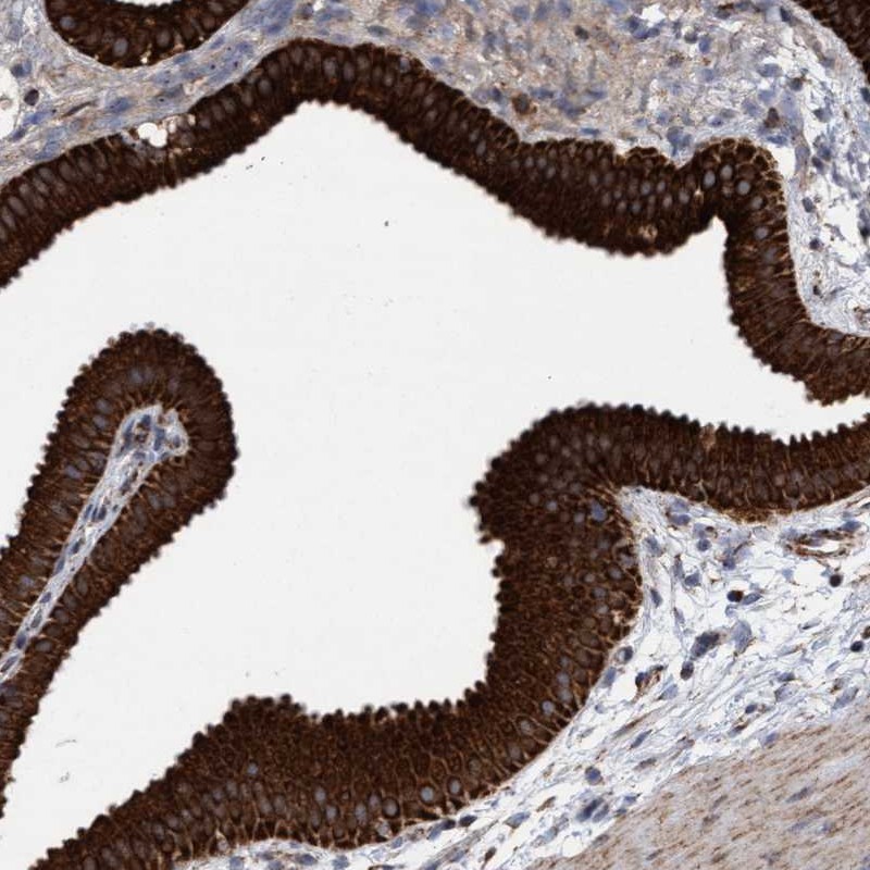 Anti-MRPL38 Antibody