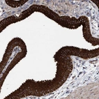 Anti-MRPL38 Antibody