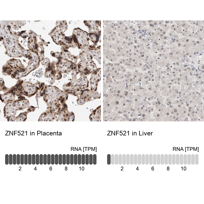 Anti-ZNF521 Antibody