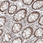 Immunohistochemical staining of human colon shows strong nuclear positivity in glandular cells.
