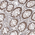 Immunohistochemical staining of human colon shows strong nuclear positivity in glandular cells.