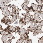 Immunohistochemical staining of human placenta shows strong nuclear positivity in trophoblastic cells.