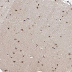 Immunohistochemical staining of human cerebellum shows strong nuclear positivity in cells in molecular layer.