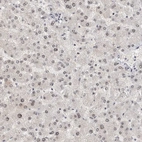 Immunohistochemical staining of human liver shows no positivity in hepatocytes as expected.