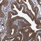Immunohistochemical staining of human Fallopian tube shows strong cytoplasmic positivity in glandular cells.