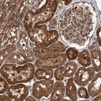 Immunohistochemical staining of human kidney shows strong cytoplasmic positivity in cells in tubules.