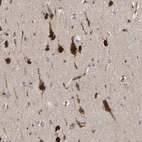 Immunohistochemical staining of human cerebral cortex shows strong cytoplasmic positivity in neurons.