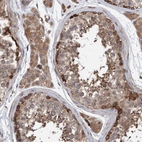 Immunohistochemical staining of human testis shows moderate cytoplasmic positivity in Leydig cells.