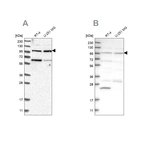 Western blot analysis using Anti-KIAA0753 antibody HPA023057 (A) shows similar pattern to independent antibody HPA023494 (B).