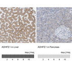 Anti-ADHFE1 Antibody