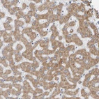 Anti-ADHFE1 Antibody