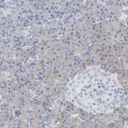 Anti-ADHFE1 Antibody