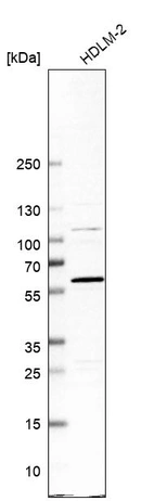 Western blot analysis in human cell line HDLM-2.
