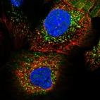 Immunofluorescent staining of human cell line A-431 shows localization to vesicles.